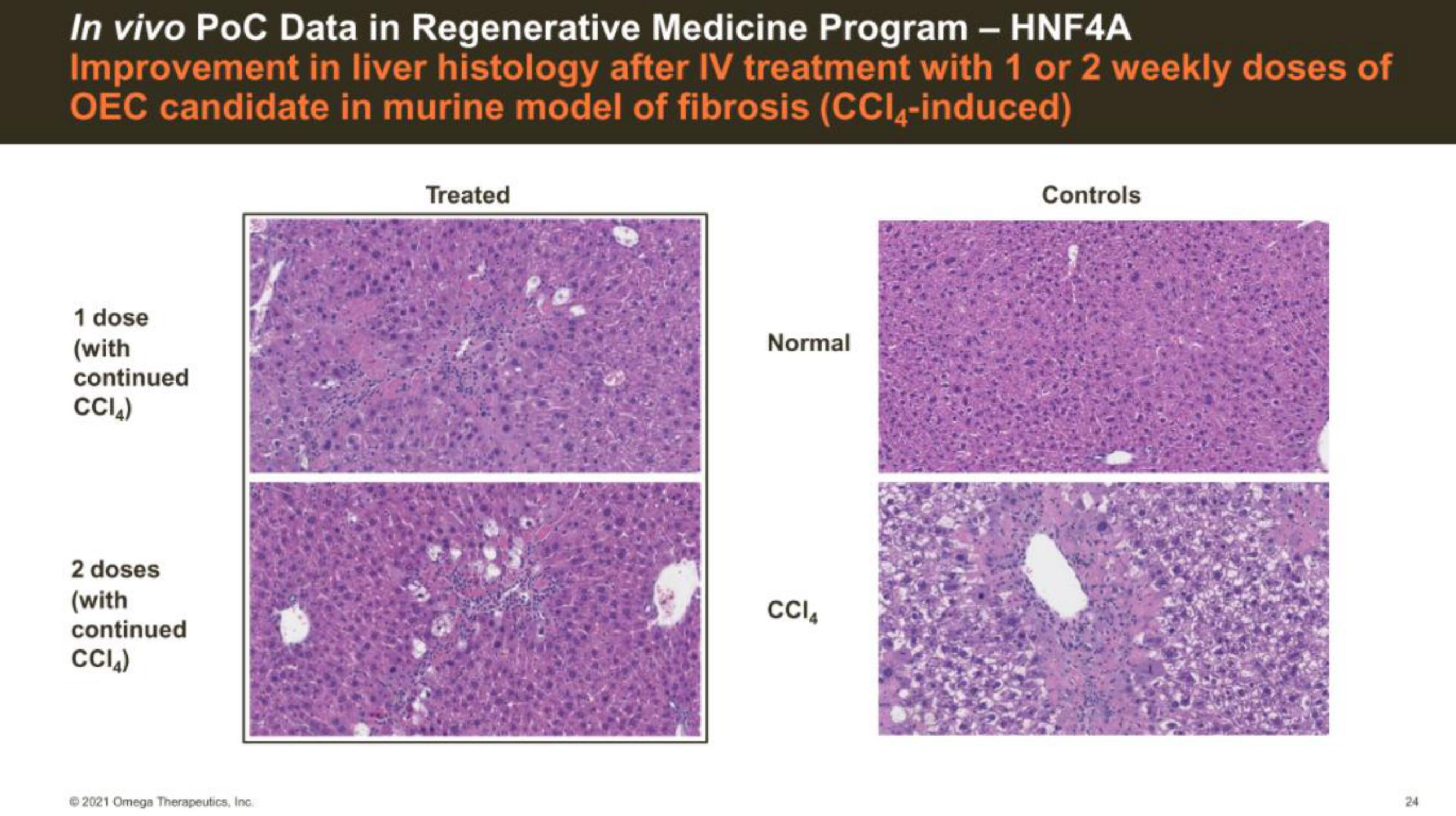 Omega Therapeutics IPO Presentation Deck slide image #24