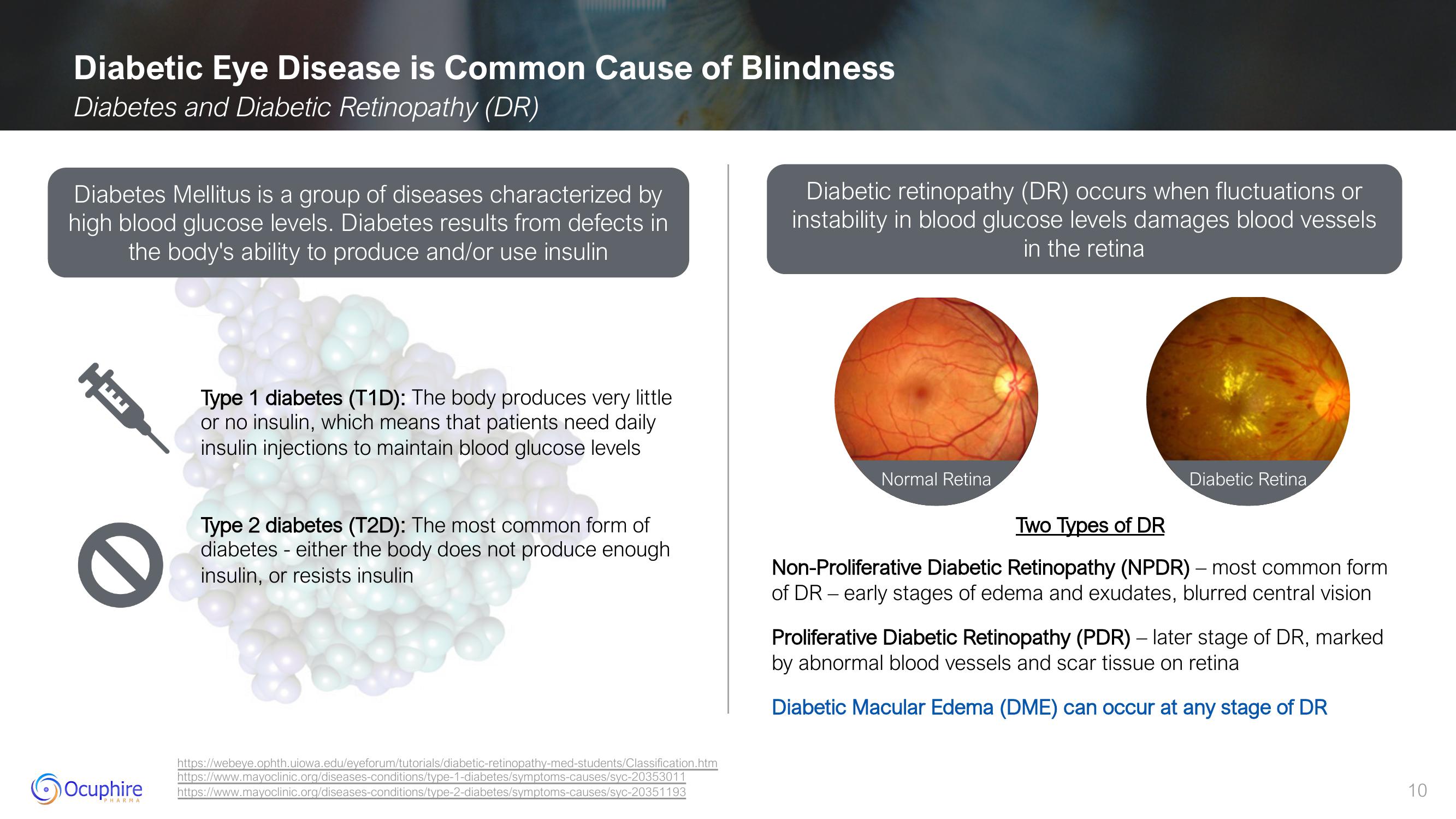 Ocuphire Pharma Results slide image #10