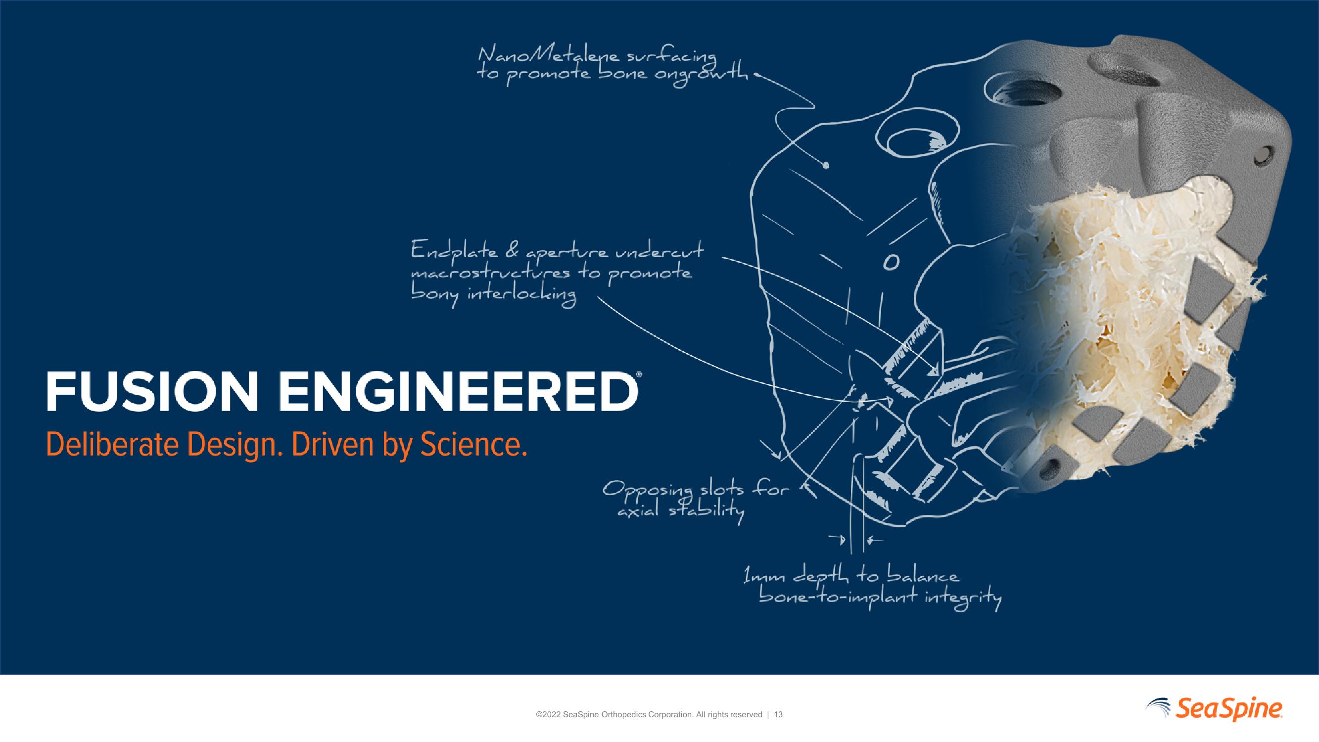 SeaSpine Investor Update slide image #13