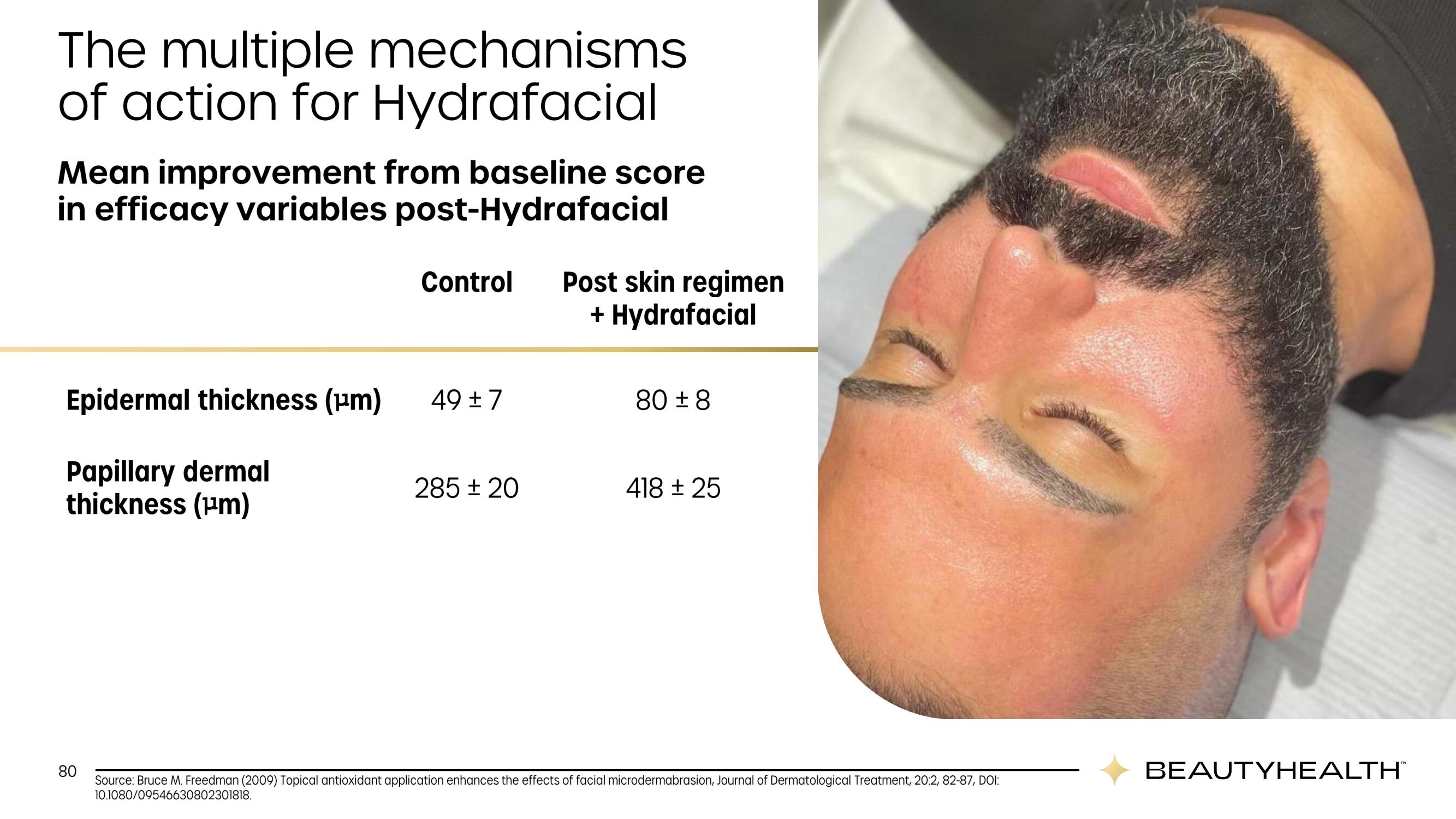 Hydrafacial Investor Day Presentation Deck slide image #80