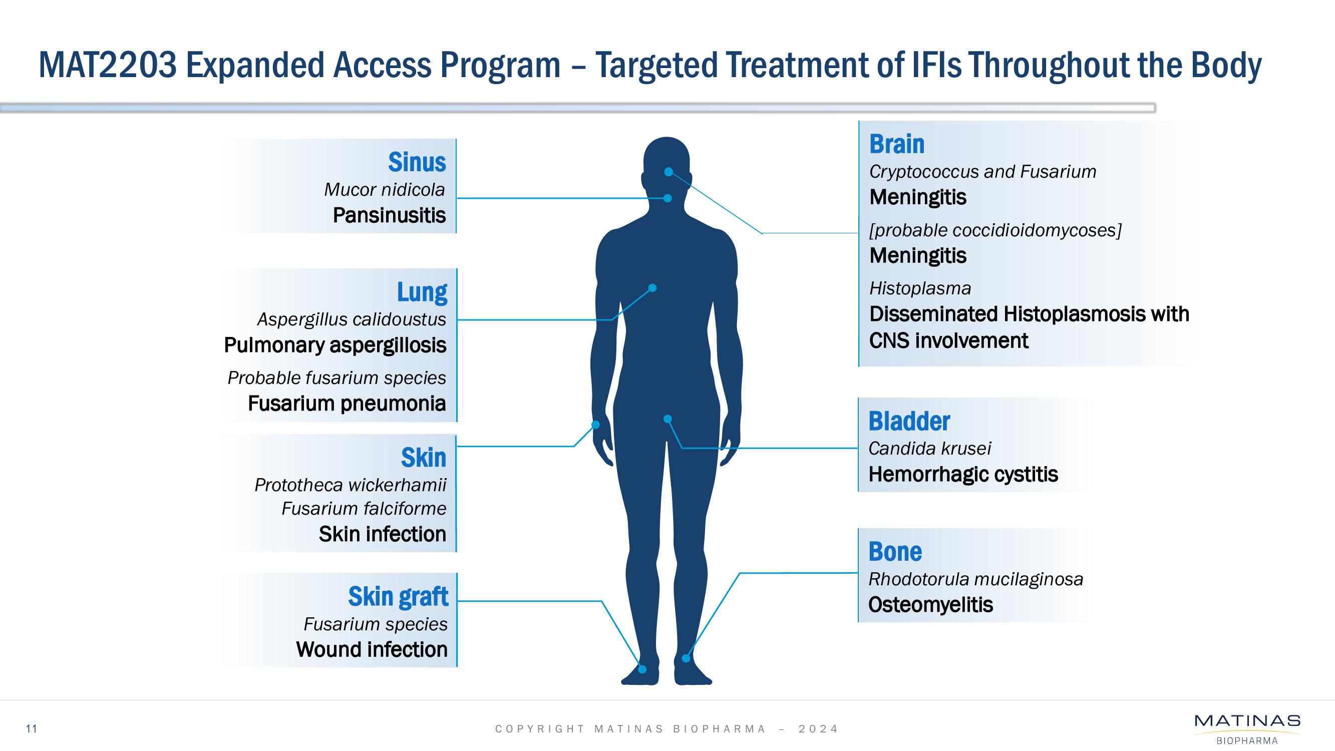 Matinas BioPharma Investor Presentation Deck slide image #11