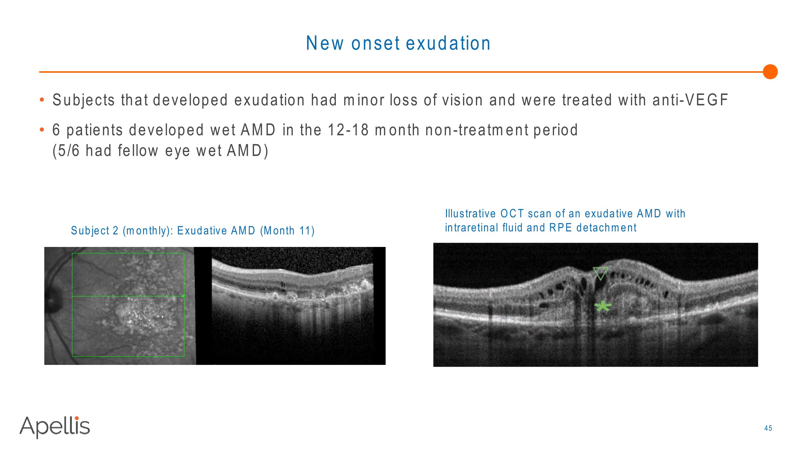 Apellis R&D Day 2018 slide image #45