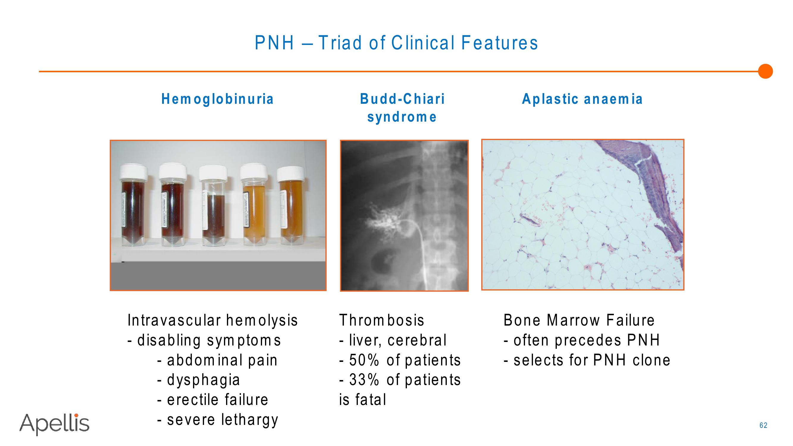 Apellis R&D Day 2018 slide image #62