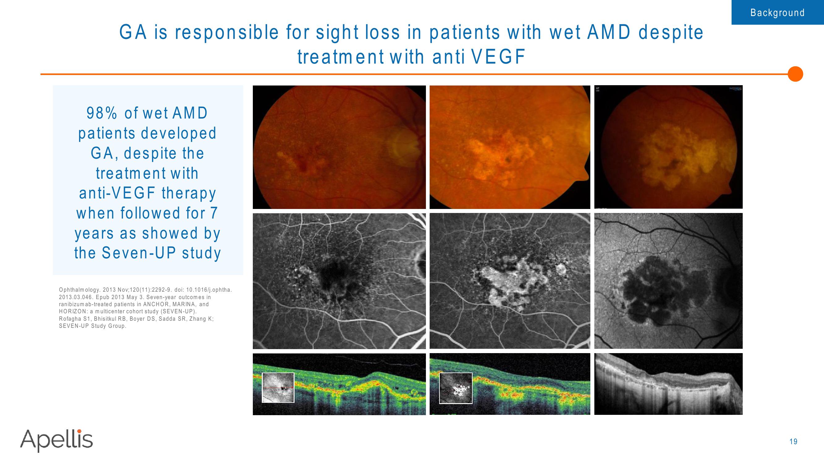 Apellis R&D Day 2018 slide image #19