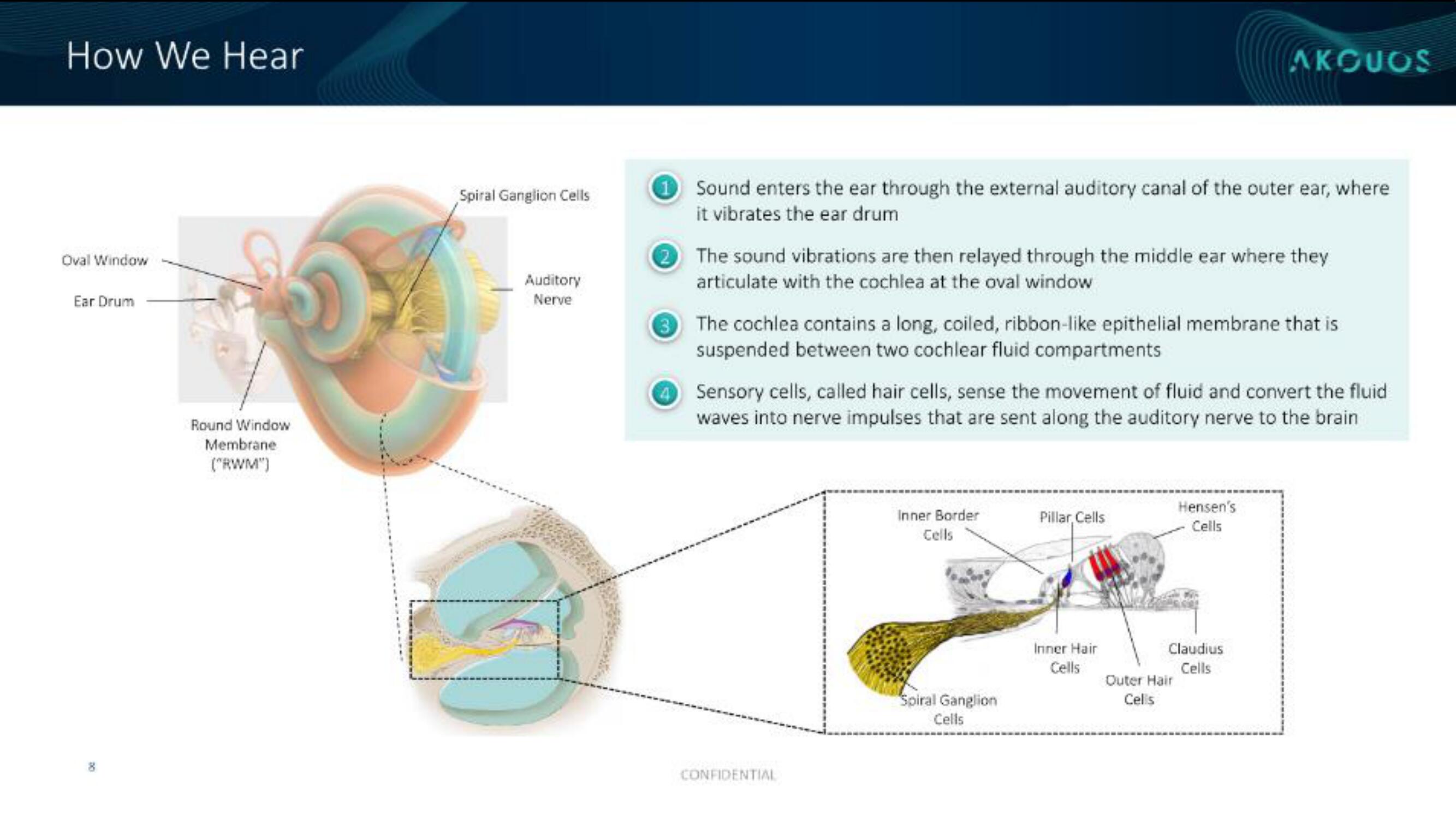 Akouos IPO Presentation Deck slide image #9