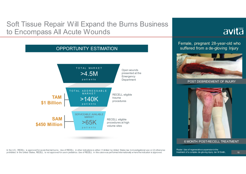 Avita Medical Presentation slide image #19