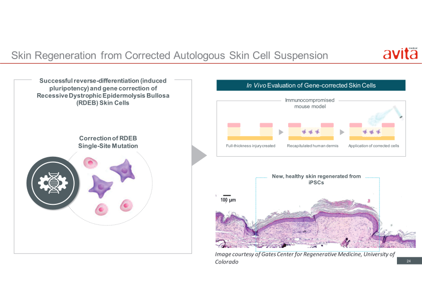 Avita Medical Presentation slide image #25