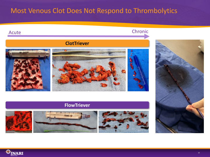 Inari Medical Investor Presentation slide image #11