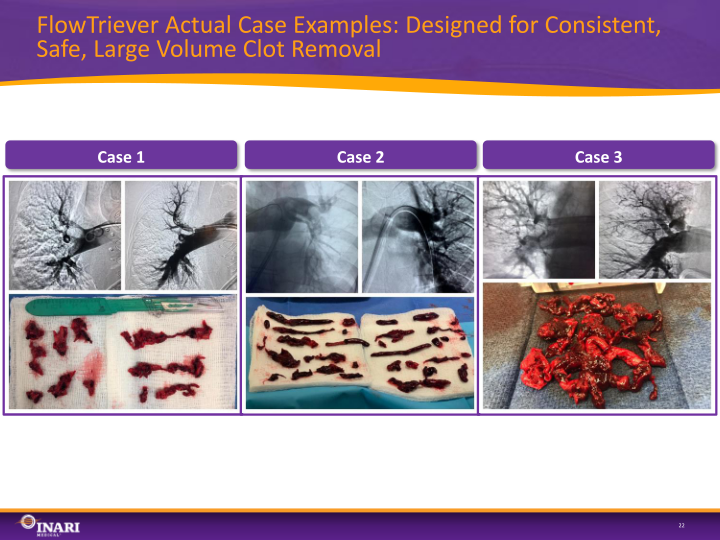 Inari Medical Investor Presentation slide image #23