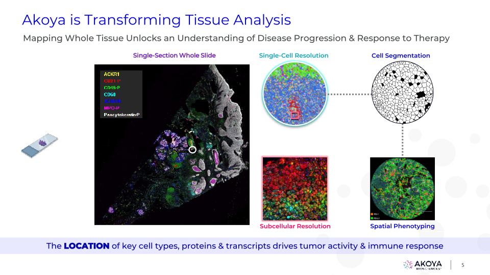 Akoya Corporate Presentation slide image #6