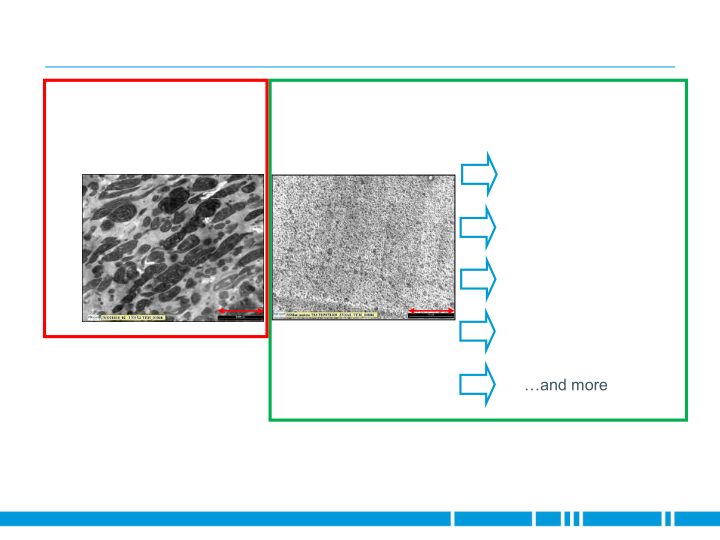 Softell Replaces Engineering Plastics for Audi Exterior Application slide image #7