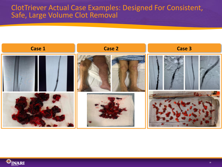 Inari Medical Investor Presentation slide image #19