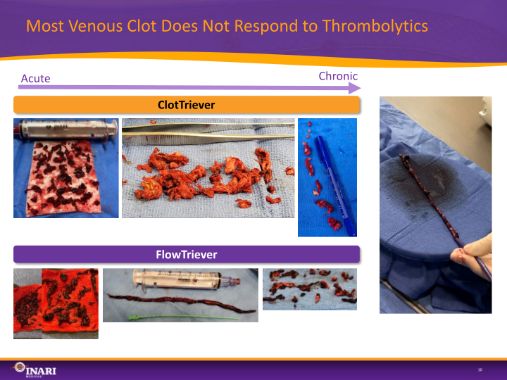 Inari Medical Investor Presentation slide image #11