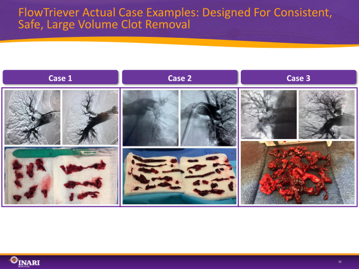 Inari Medical Investor Presentation slide image #21