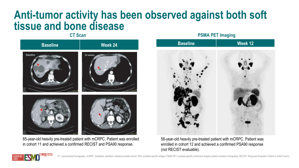 Hematology / Oncology Update Esmo 2023 slide image #32